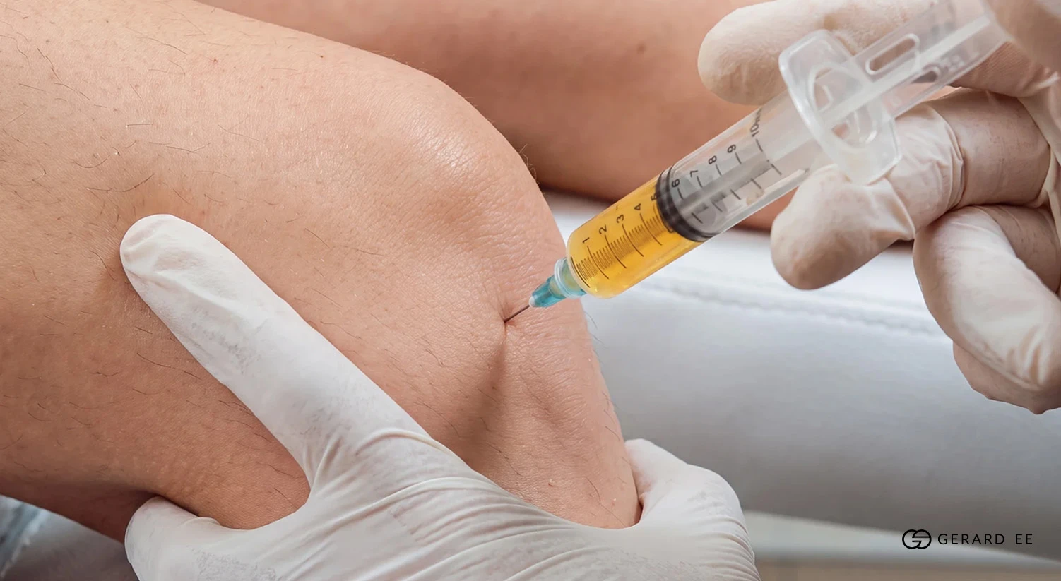 knee injection dr gerardee Knee joint injection for osteoarthritis