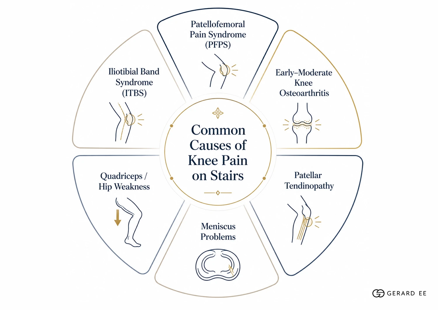 Common Causes Common causes of knee pain on stairs