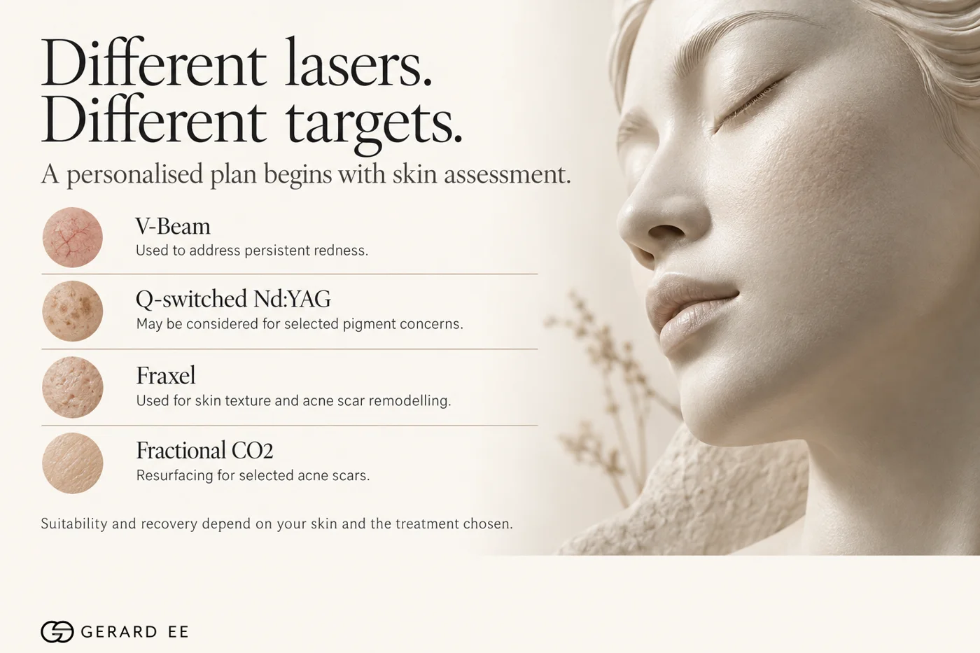 Which laser for which acne scar: V Beam for redness, Q-switched Nd:YAG for pigment, Fraxel for texture, fractional CO2 for resurfacing