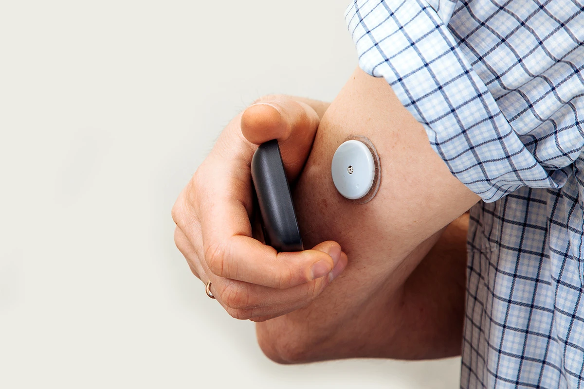 Continuous glucose monitor used in longevity medicine
