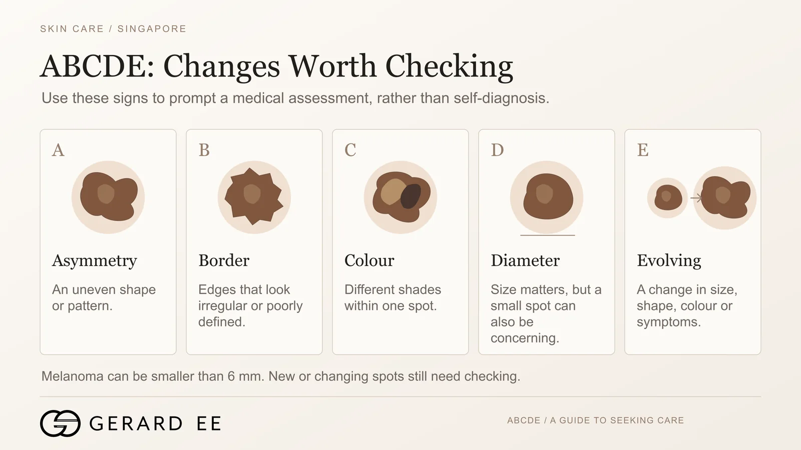 ABCDE signs of a changing mole worth checking, asymmetry, border, colour, diameter, evolving