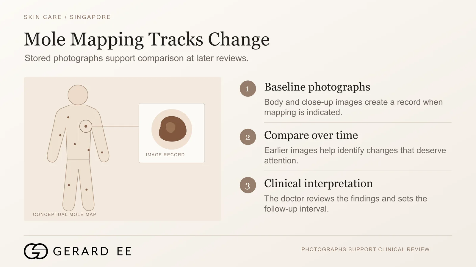 Mole mapping alongside mole removal in Singapore, baseline photographs compared over time to track change
