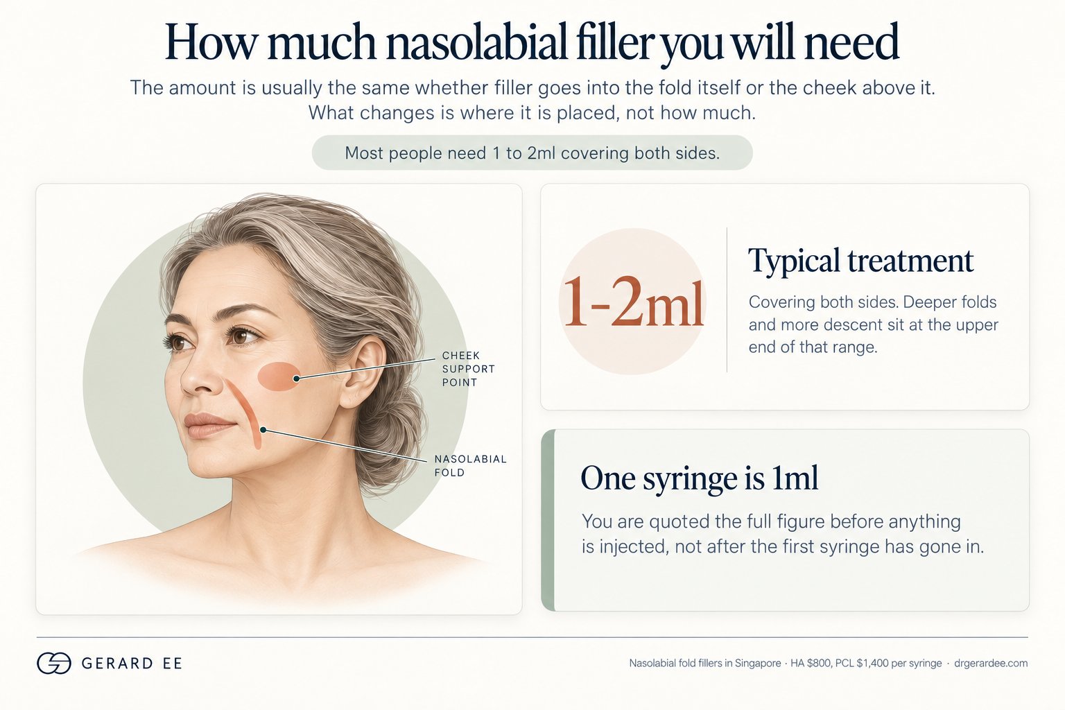 How much nasolabial filler is needed: 1 to 2ml covering both sides