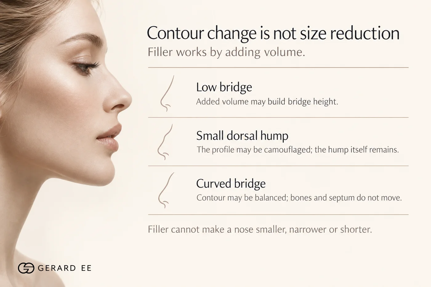 Contour change is not size reduction: what nose filler does for a low bridge, small dorsal hump and curved bridge