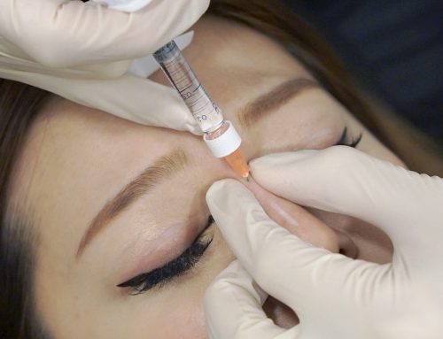 Nose Fillers in Singapore, A Complete Review Balancing Beauty, Results and Safety
