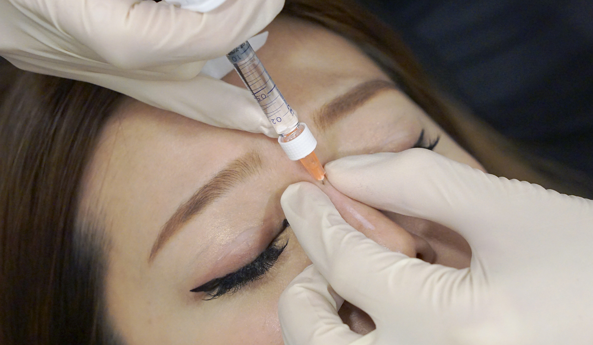 nose filler dge