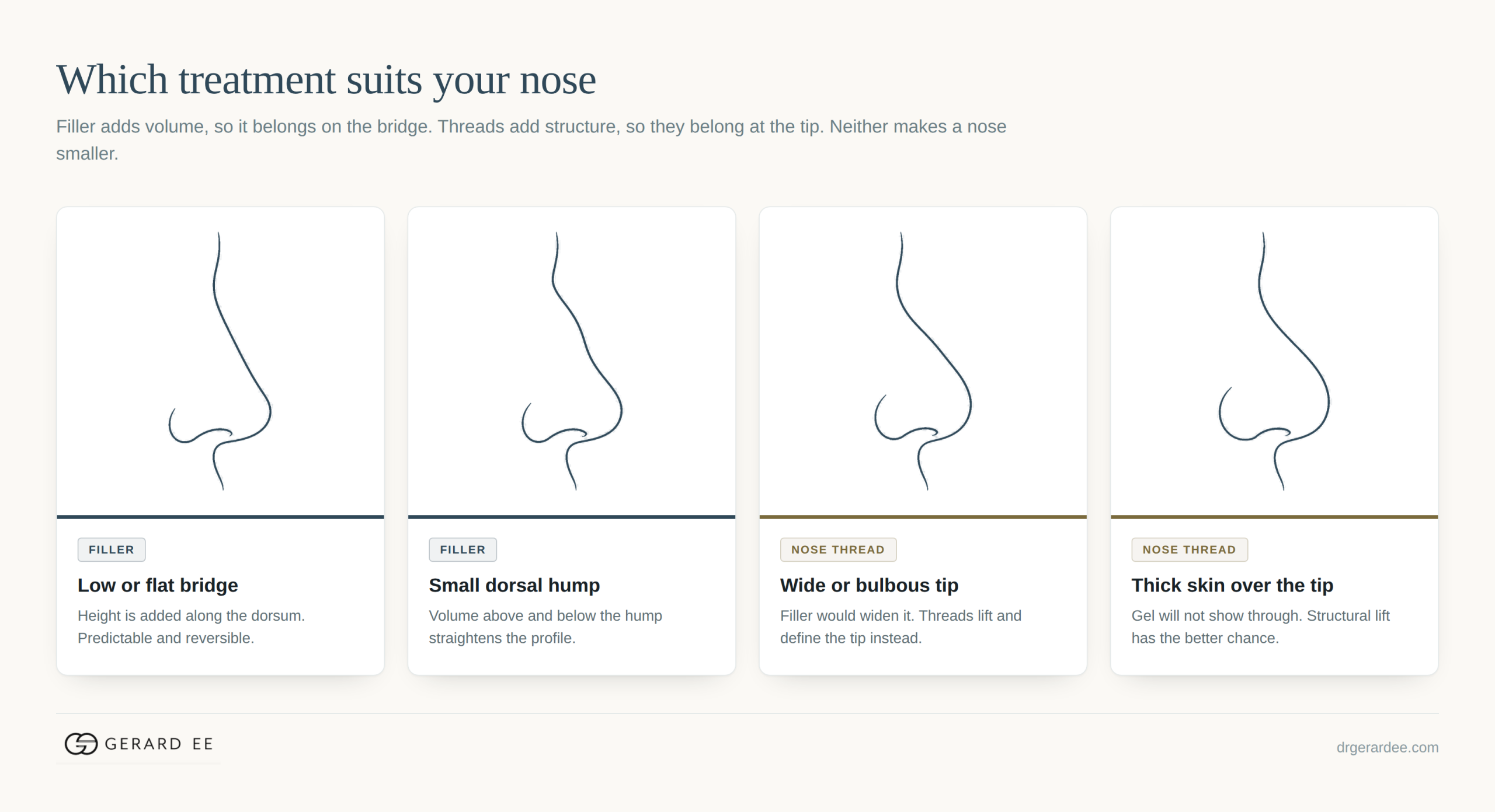 Which nose shapes suit nose filler and which suit nose threads