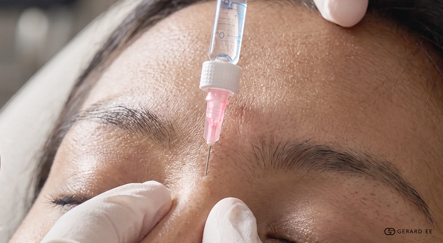 Nose fillers sg2: What nose fillers cost in Singapore