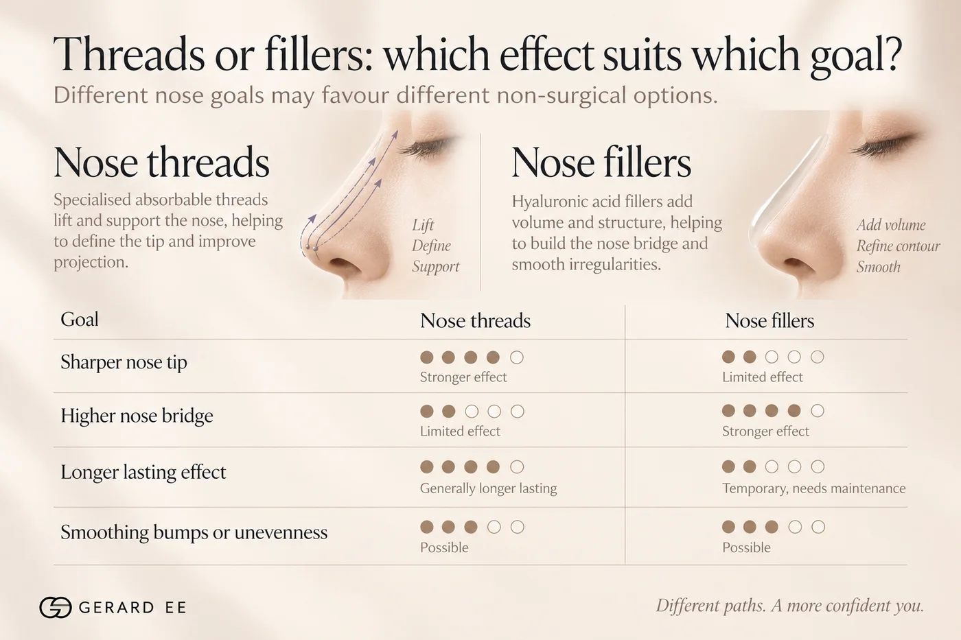 Nose threads vs nose fillers by goal: threads for a sharper tip and longer-lasting effect, fillers for a higher nose bridge, both can smooth bumps