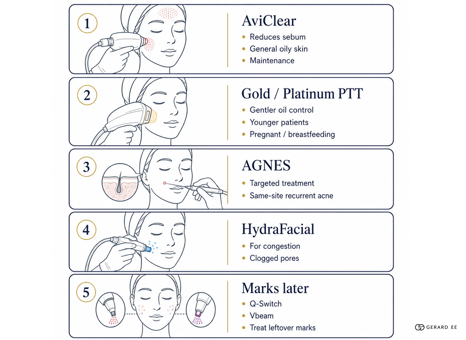 acne treatments dge Acne treatments for oily skin in Singapore