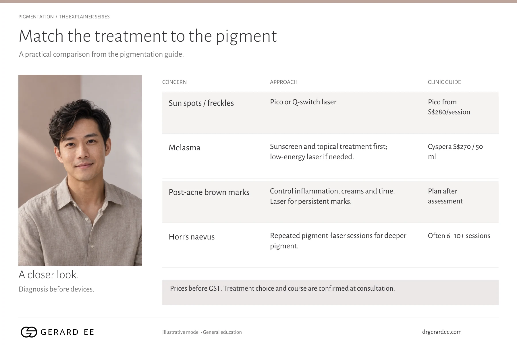 Sun spots, melasma, post-acne brown marks and Hori's naevus matched to their treatment approach and clinic guide prices in Singapore