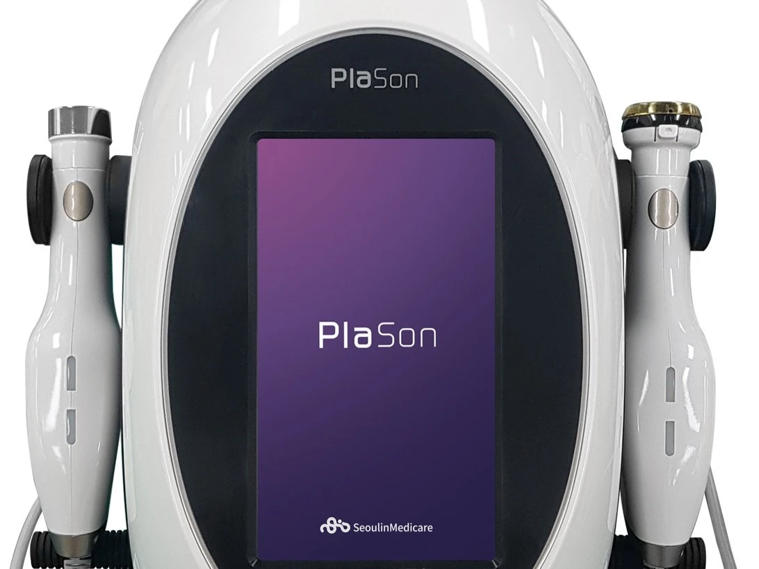 Plason plasma facial treatment for acne