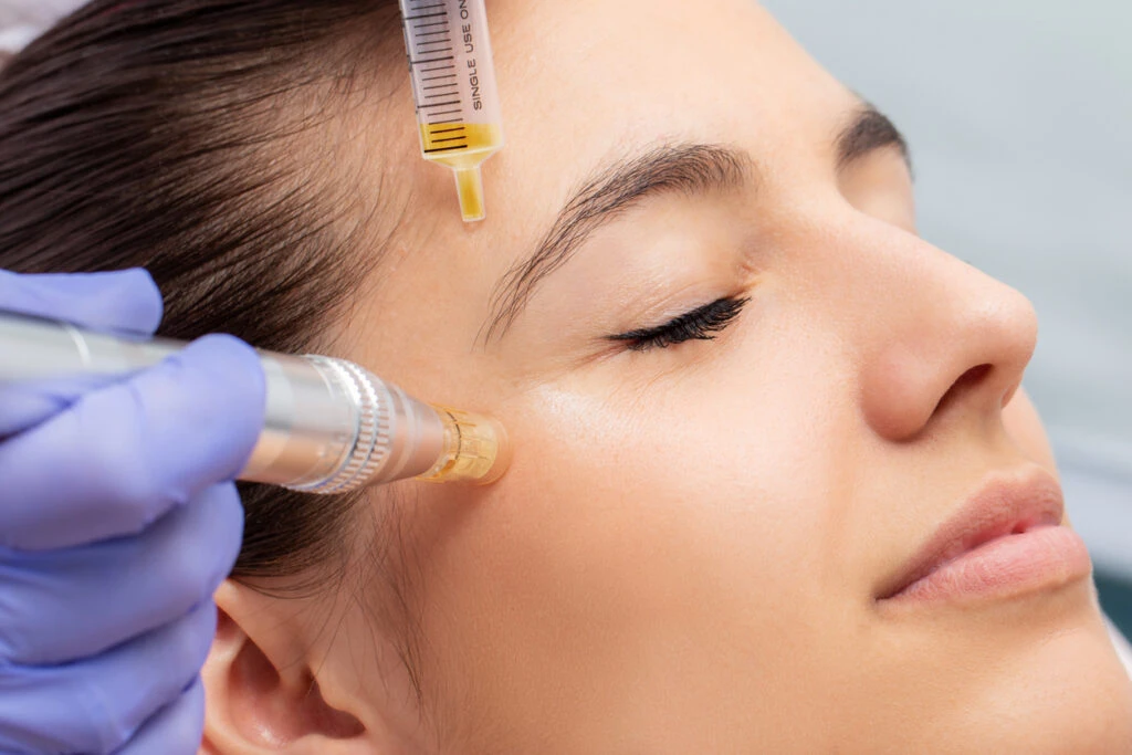 Plasma facial treatment for skin rejuvenation