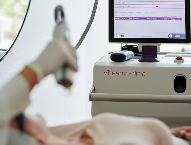 Pulse dye laser: PUVA therapy