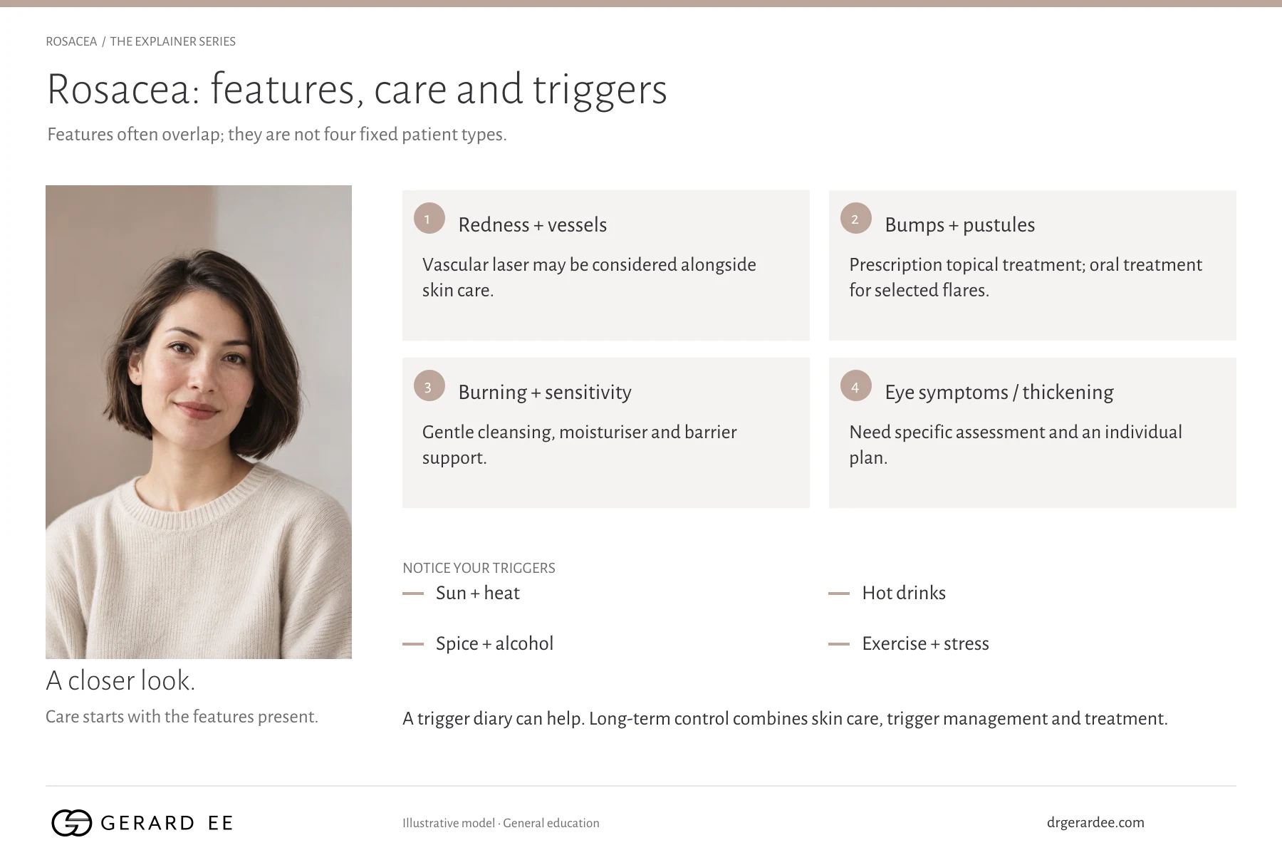 The four rosacea feature groups, redness with visible vessels, bumps and pustules, burning and sensitivity, and eye symptoms or skin thickening, with the common triggers