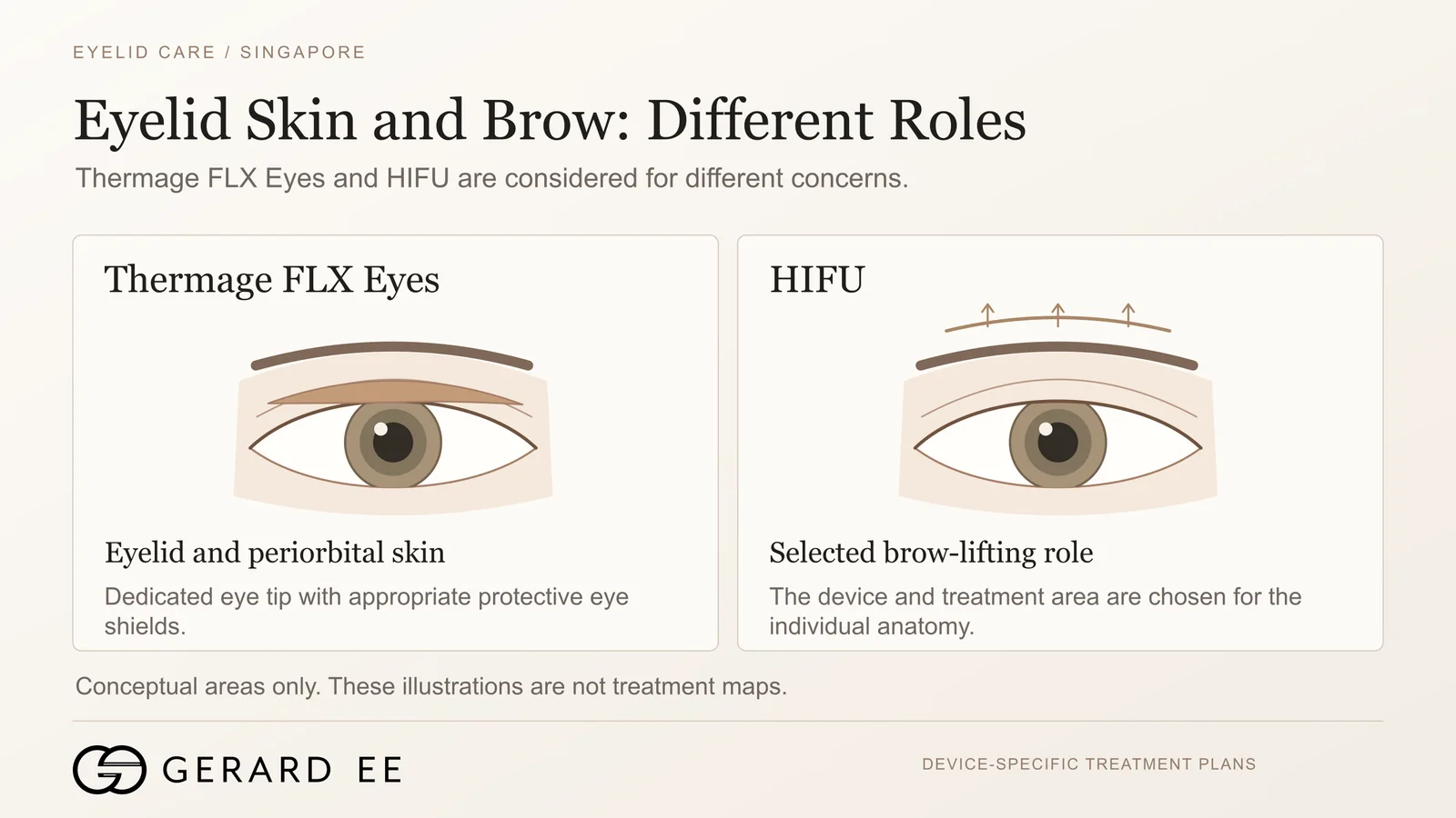 Thermage FLX Eyes for eyelid skin and HIFU for brow lifting in sagging eyelid treatment