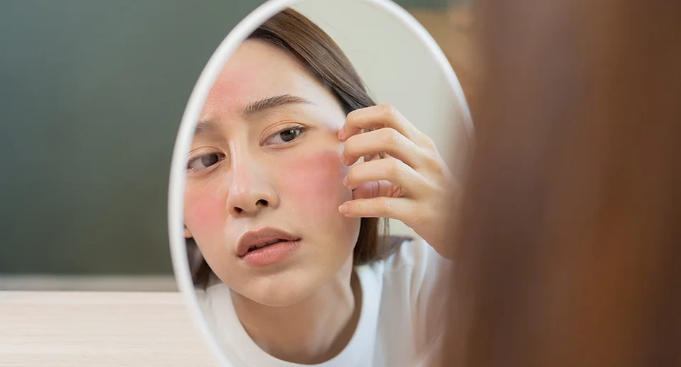 Sensitive skin with facial redness checked in a mirror