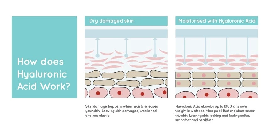 Diagram of how hyaluronic acid skin boosters hydrate the skin