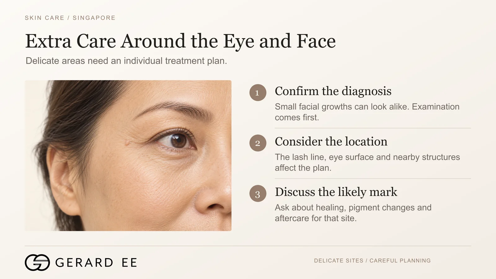 Extra care for skin tag removal around the eye and face in Singapore