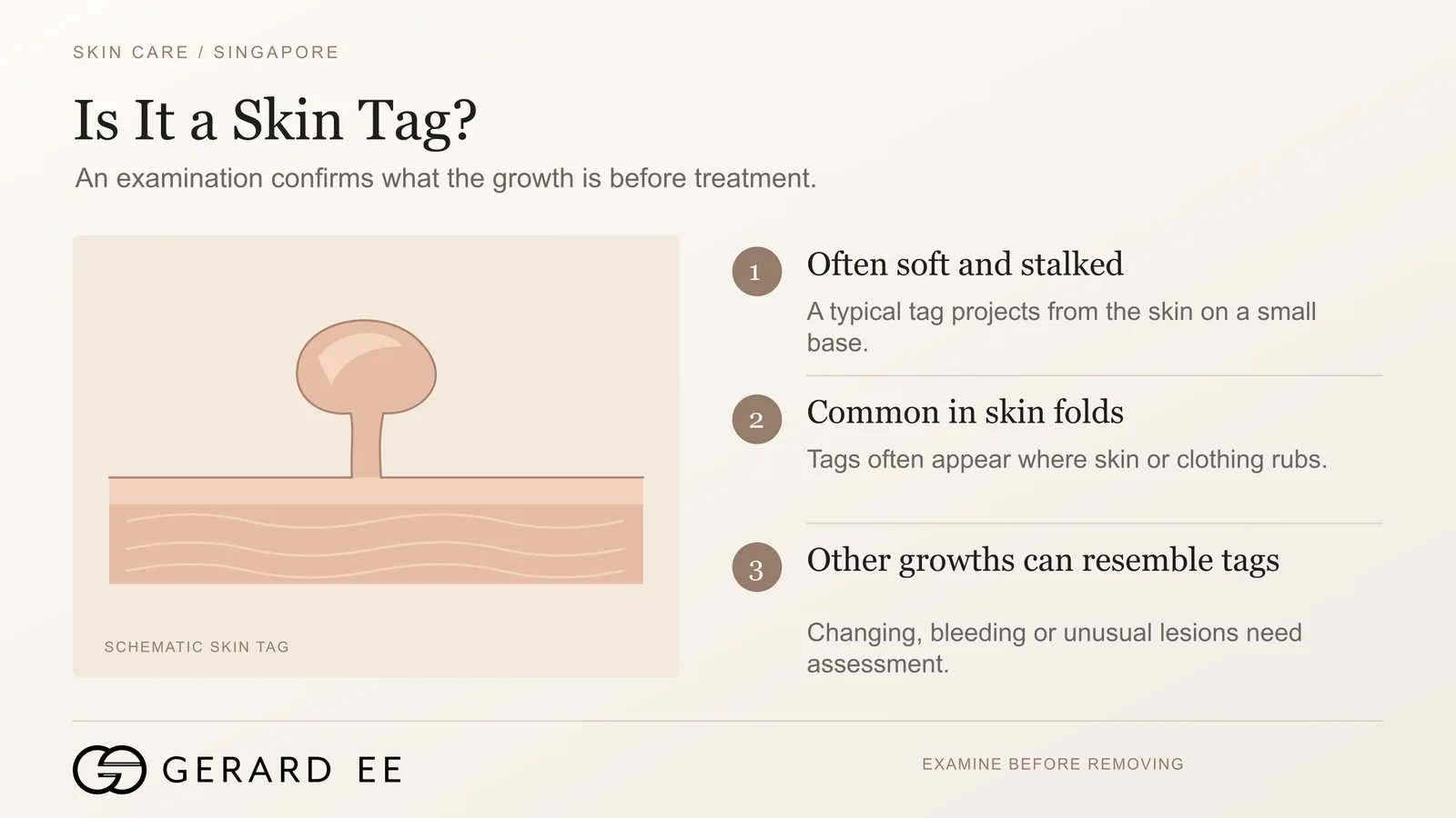 Is it a skin tag, schematic of a soft stalked skin tag and the growths that can resemble one