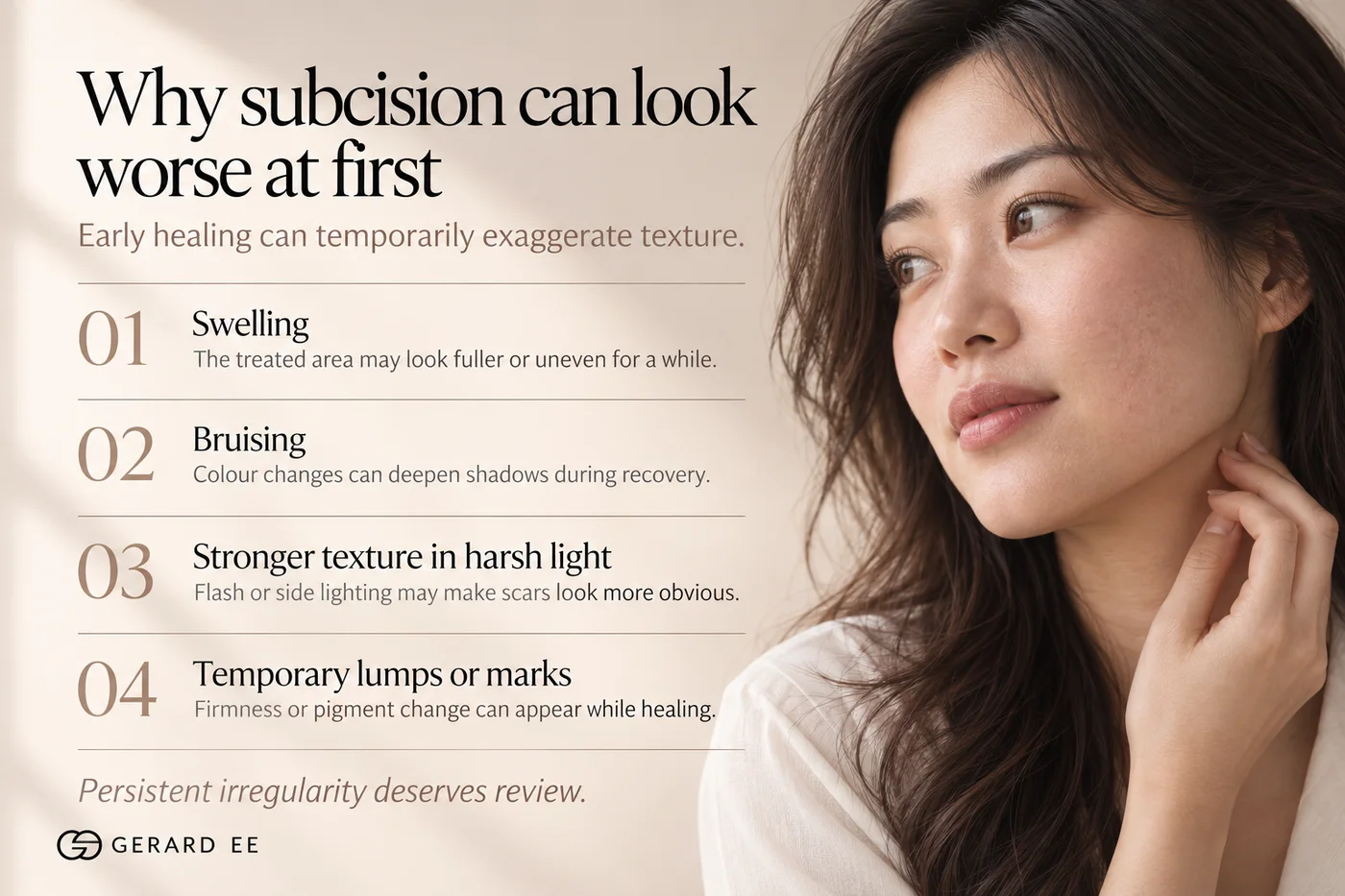 Why subcision can look worse at first: swelling, bruising, harsh light and temporary lumps