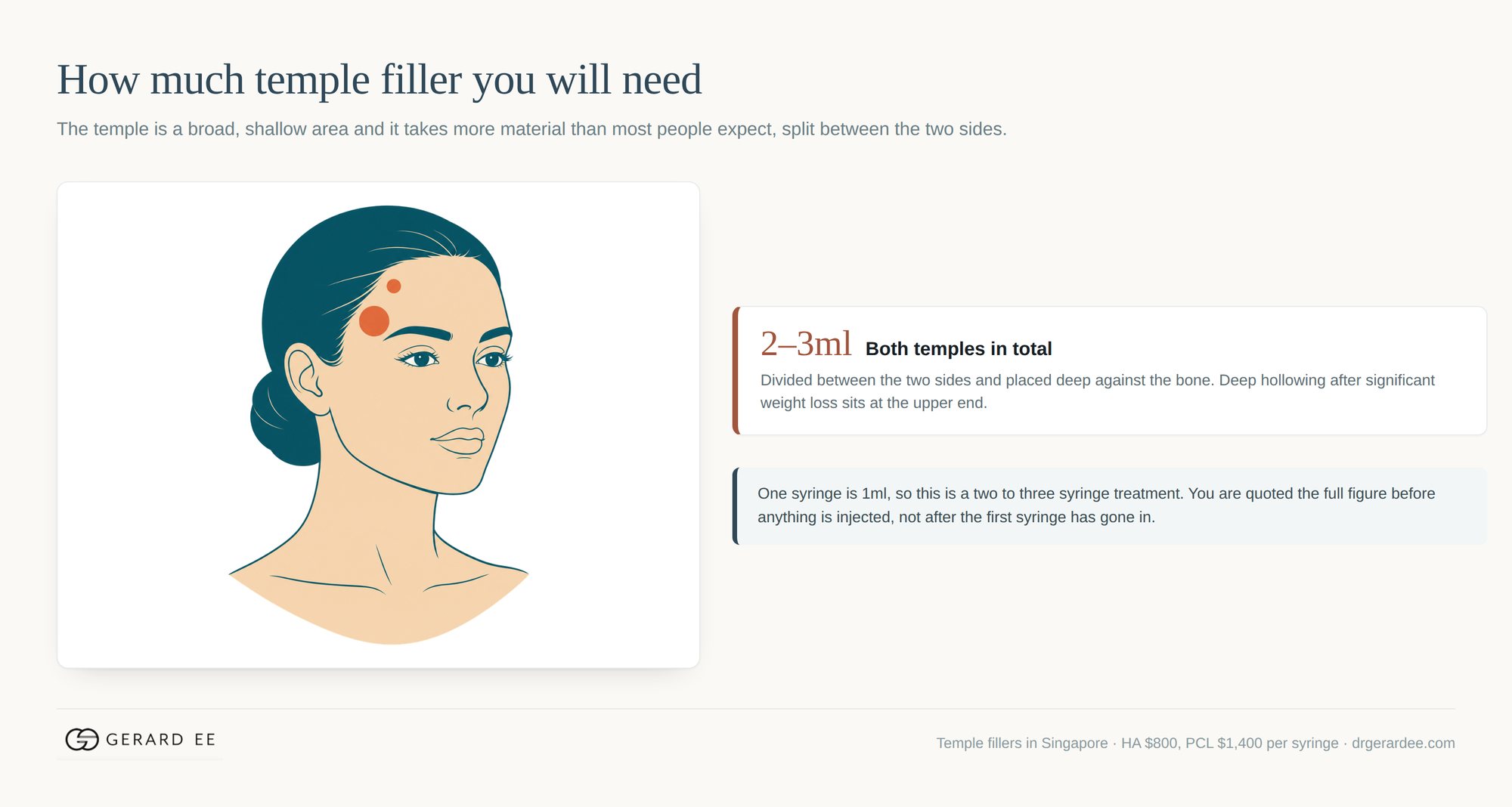How much temple filler is needed: 2 to 3ml in total, divided between both sides