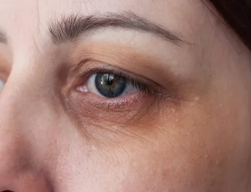 Under-Eye Skin Boosters Compared: Rejuran, Juvelook, Re20 and CellREDM