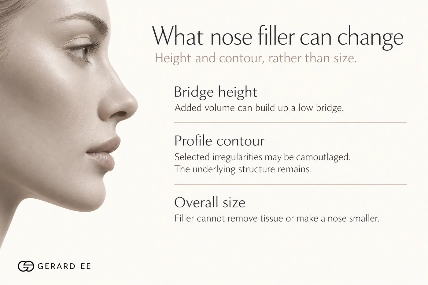 What nose filler can change: bridge height and profile contour, not overall size