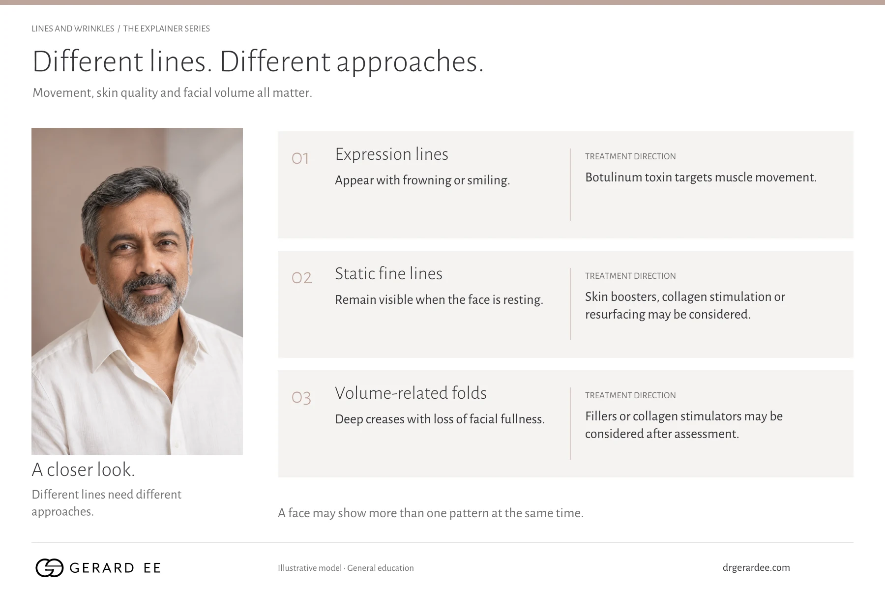 Expression lines, static fine lines and volume-related folds compared, with the treatment direction for each