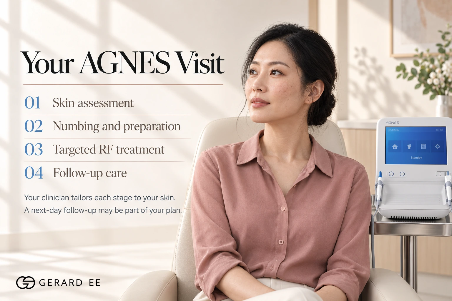 What to expect during AGNES RF acne treatment in Singapore