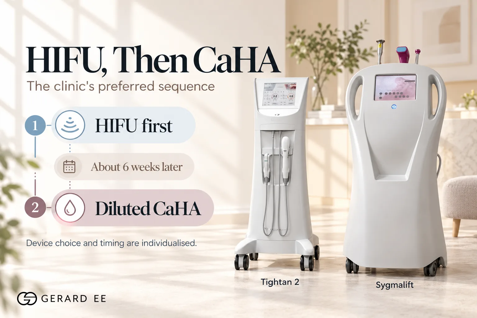 HIFU first then diluted CaHA about six weeks later, with Tightan 2 and Sygmalift HIFU
