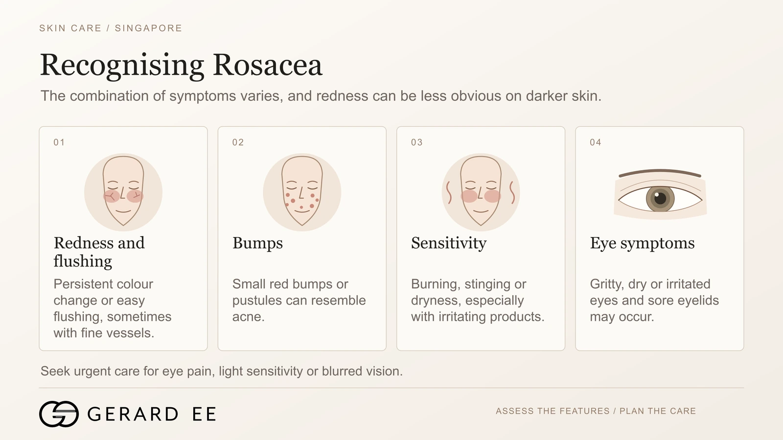 Recognising rosacea symptoms, redness and flushing, bumps, sensitivity and eye symptoms