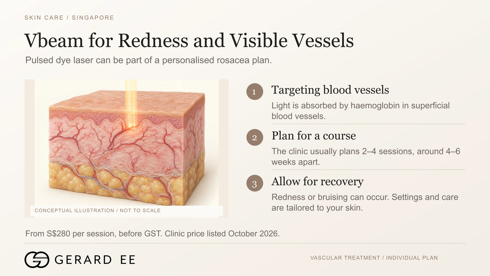 Vbeam pulsed dye laser for rosacea redness and visible vessels in Singapore, from S$280 per session