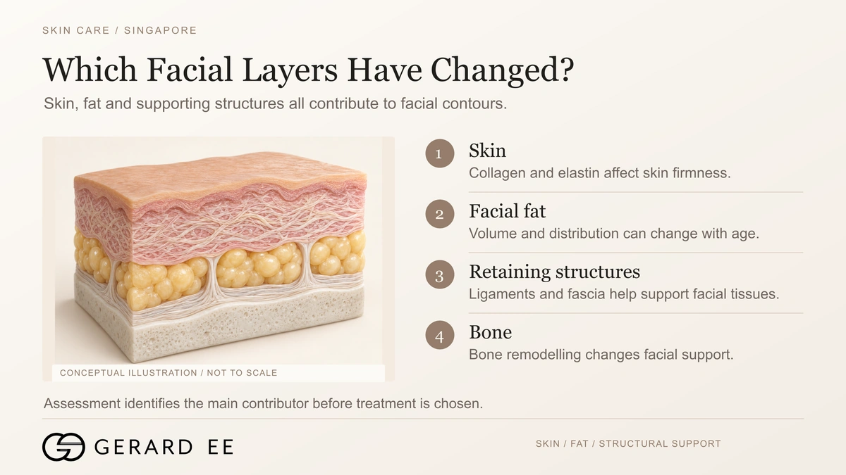 Sagging skin treatment Singapore, which facial layers have changed, skin, facial fat, retaining structures and bone